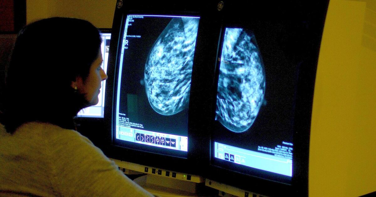 AI helping to transform breast cancer care in Ireland