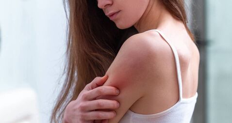 Young woman suffering from itching on her skin and scratching an itchy place. Allergic reaction to insect bites, dermatitis, foo