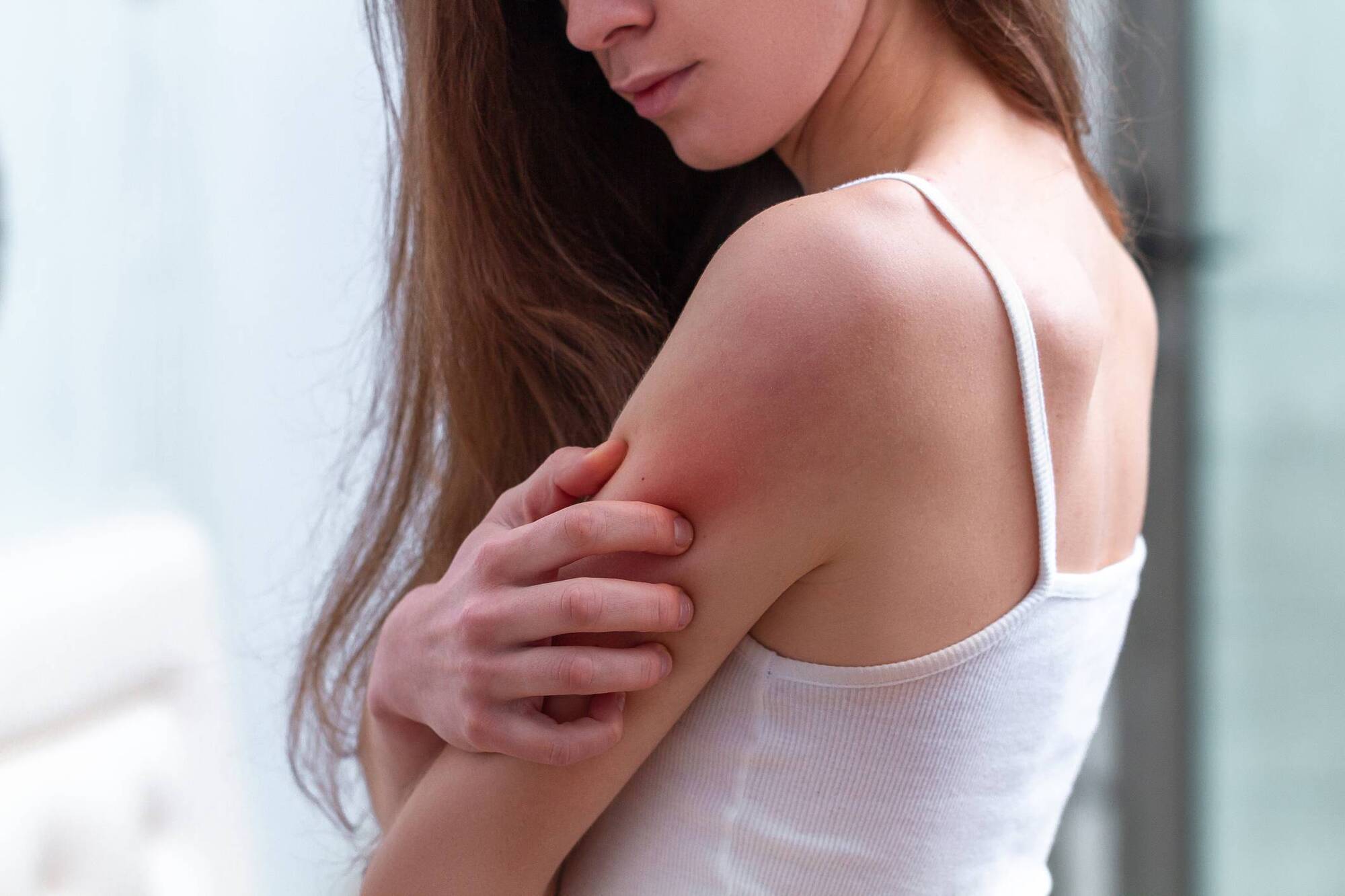 Natural health:  What can I do to treat my psoriasis? 