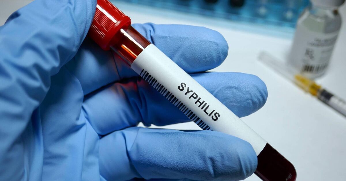 Over 1,600 sexually transmitted infections recorded in Ireland in January