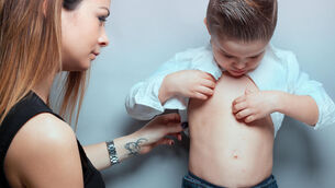 <p>Ireland has earned its World Health Organization measles-free designation due to its assiduous vaccination campaign. Let's keep it that way. Stock picture: Alamy</p>