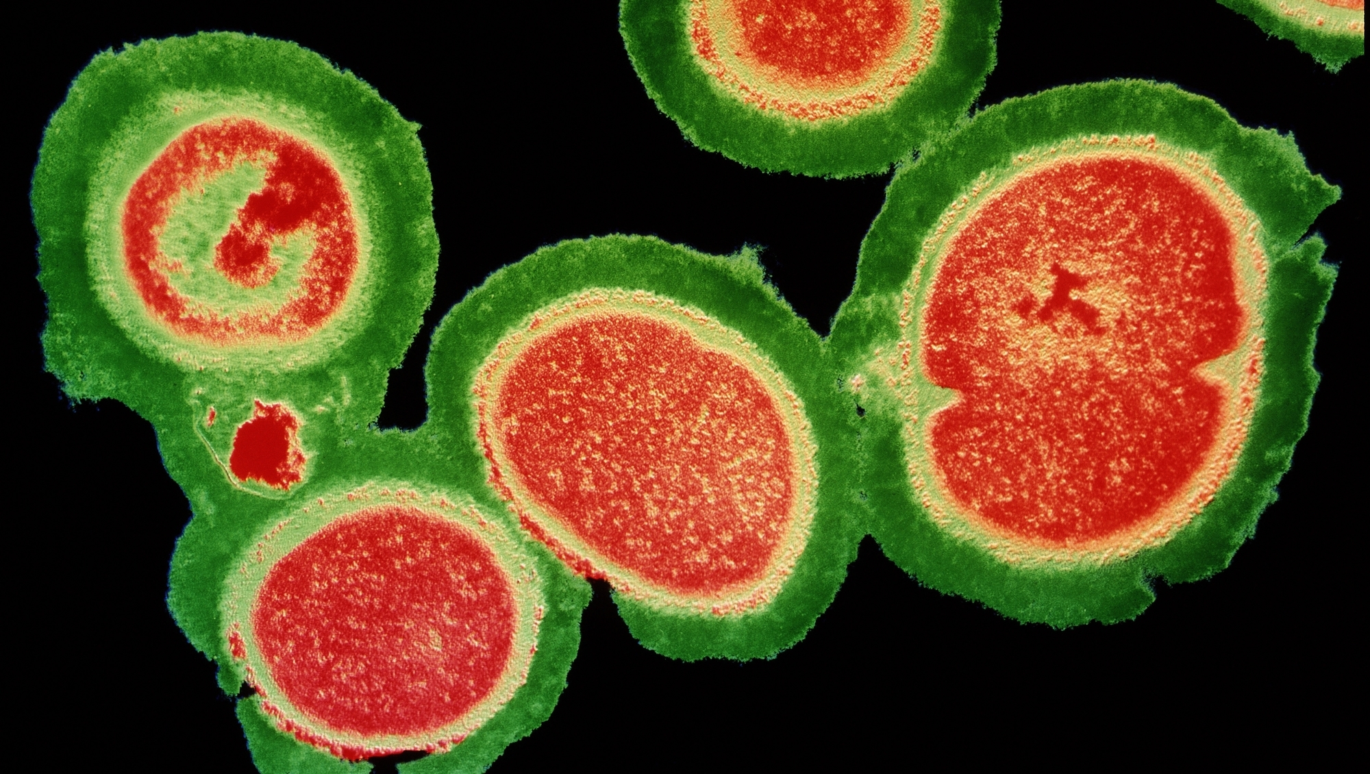 Pipeline of new drugs to fight superbugs is ‘worryingly thin’, experts warn